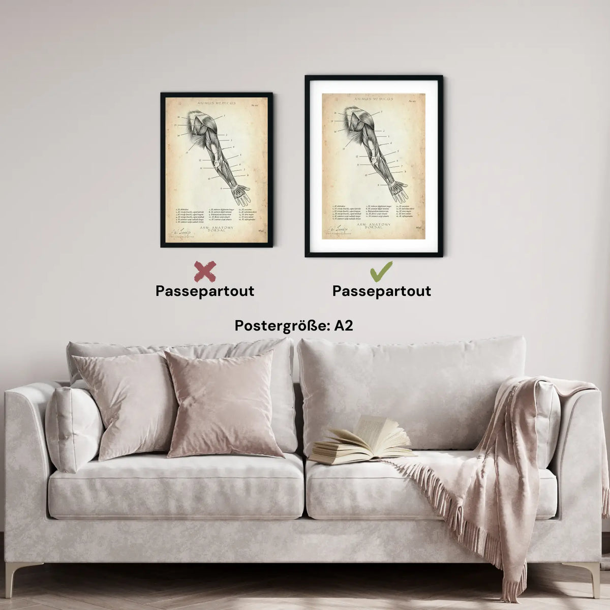 Arm Anatomie dorsal - Animus Medicus GmbH