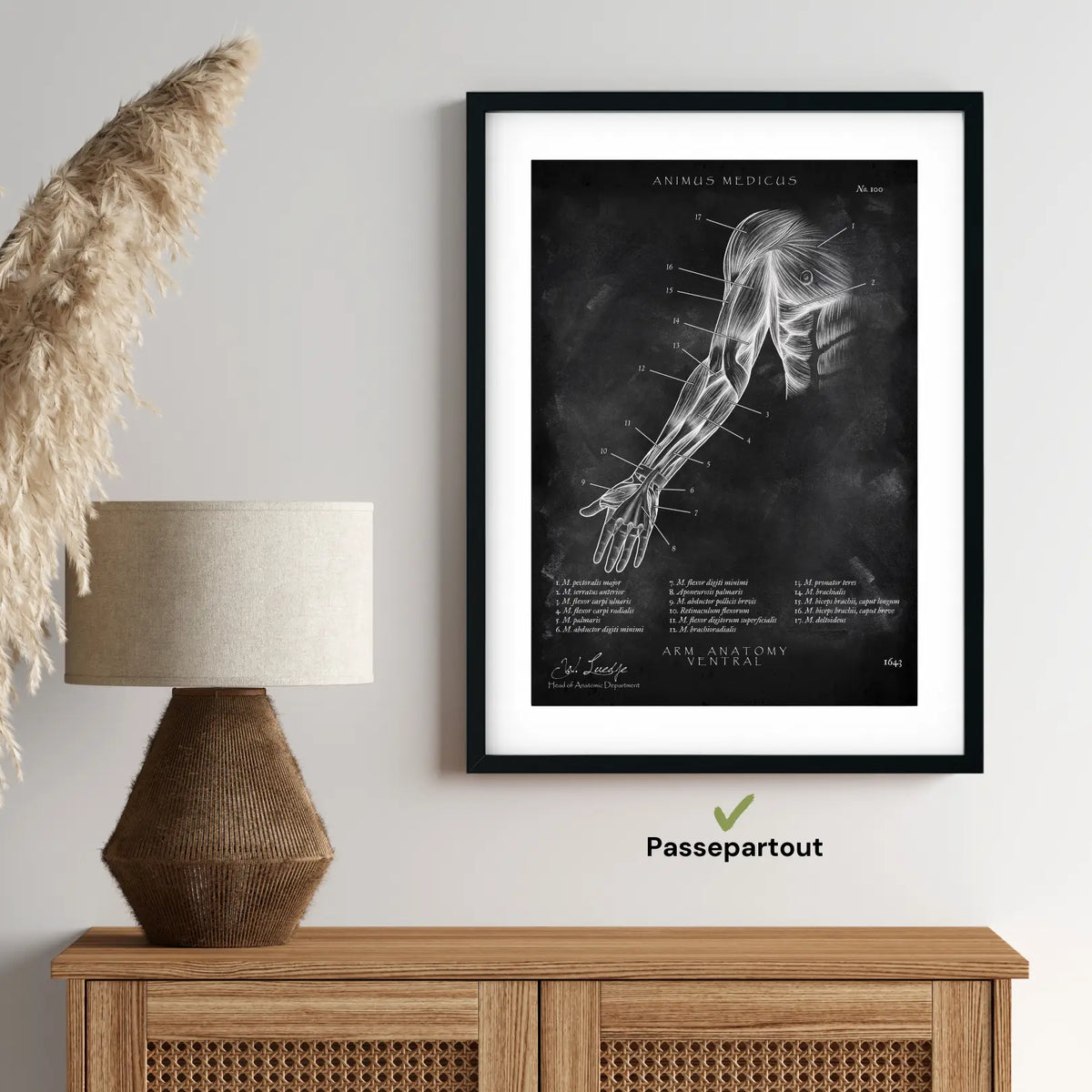 Arm Anatomie ventral - Chalkboard - Animus Medicus GmbH