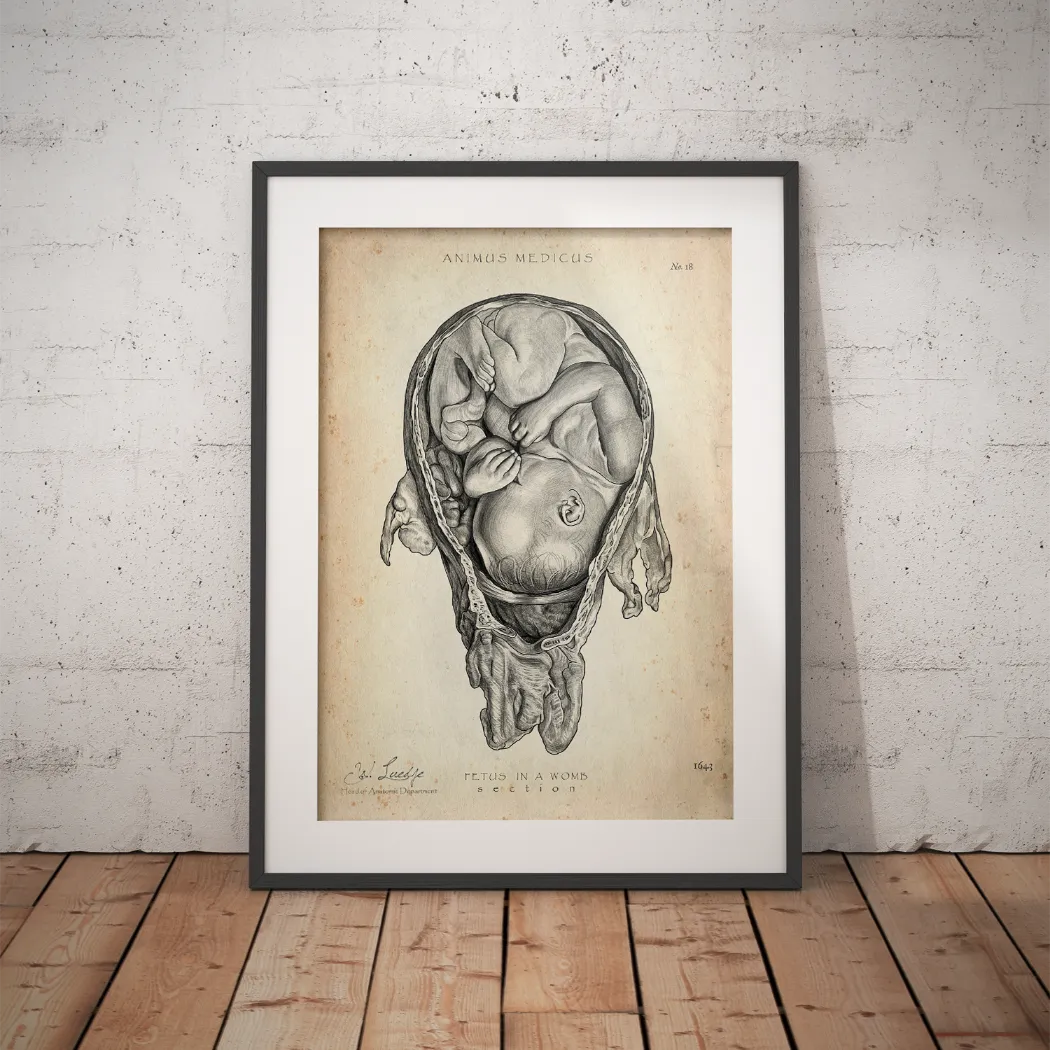 Baby in Gebärmutter - Animus Medicus GmbH