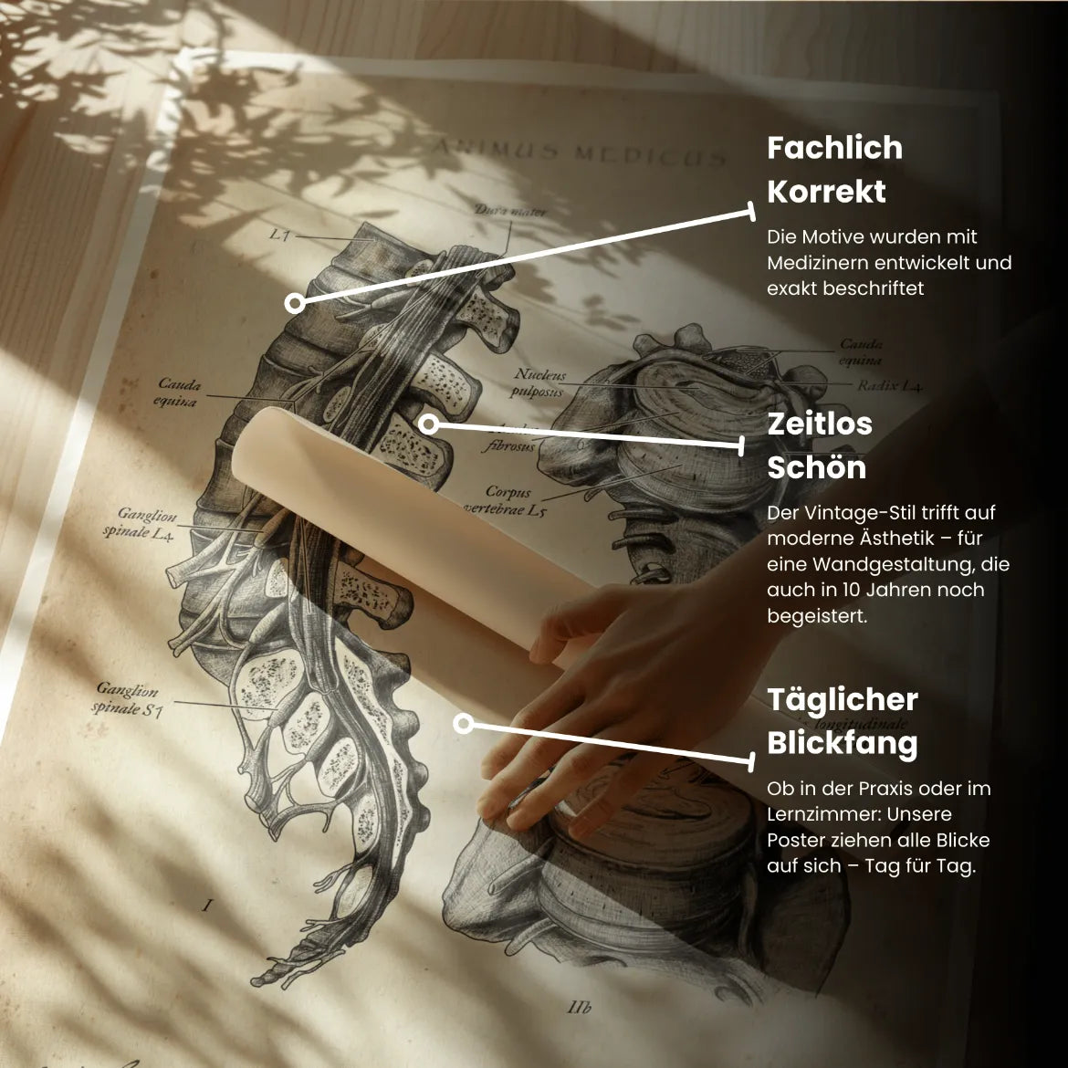 Bandscheibenvorfall Anatomie Poster - Animus Medicus GmbH
