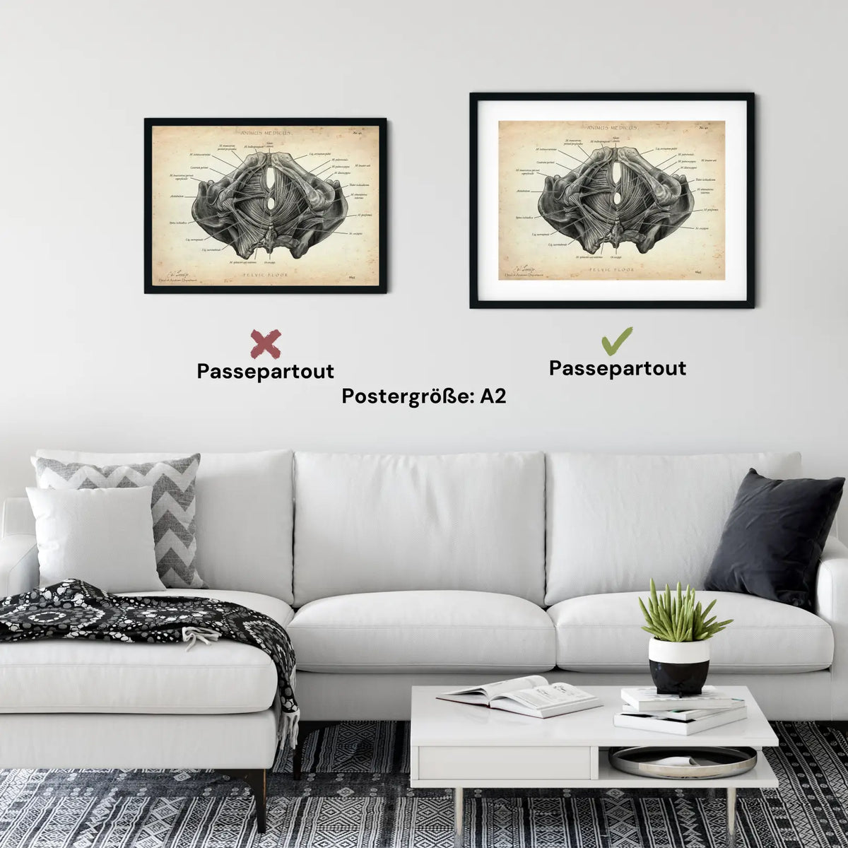 Beckenboden Muskulatur - Animus Medicus GmbH