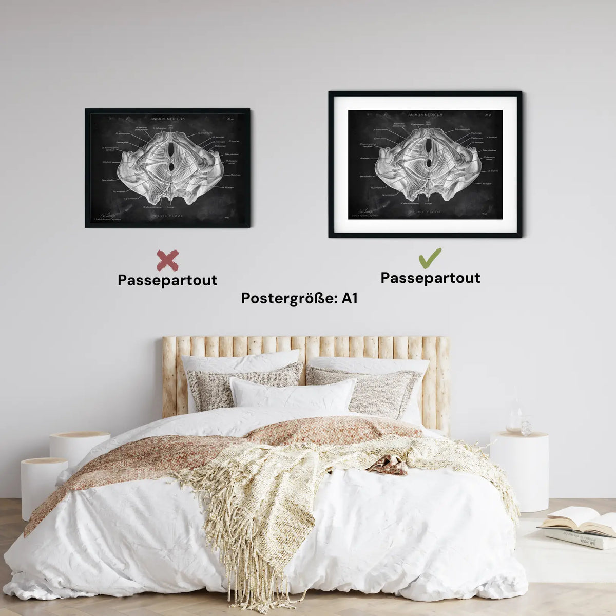 Beckenboden Muskulatur - Chalkboard - Animus Medicus GmbH