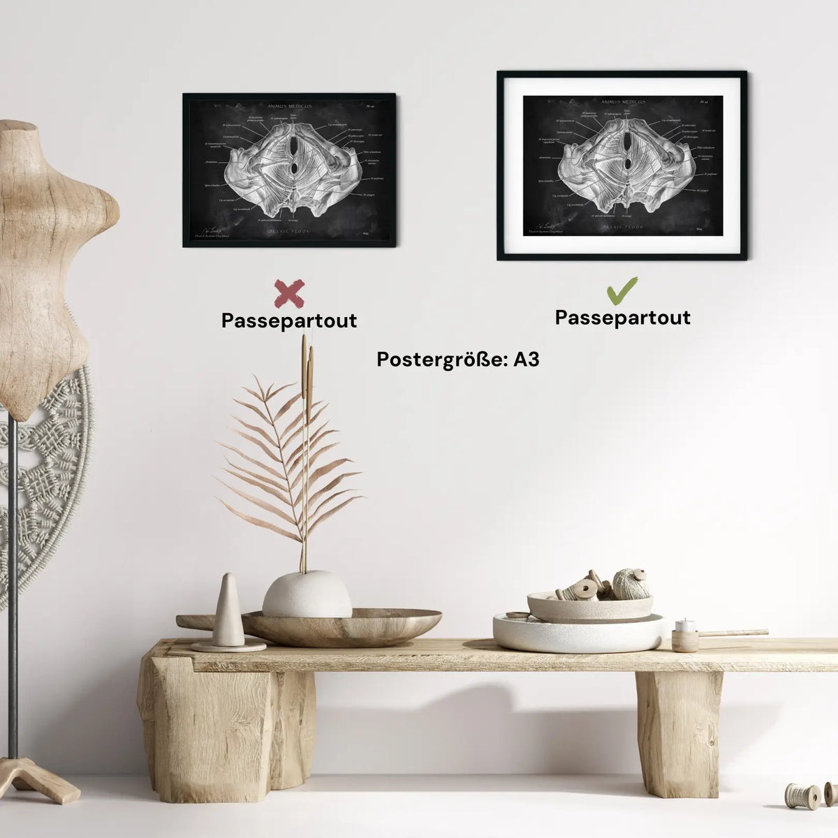 Beckenboden Muskulatur - Chalkboard - Animus Medicus GmbH