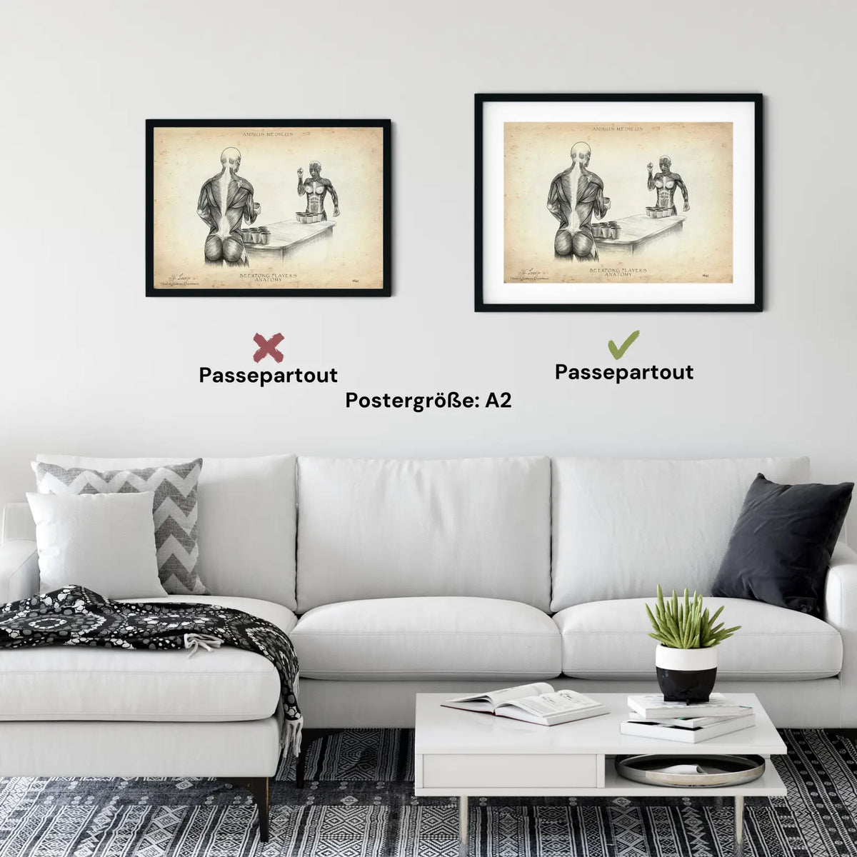 Beerpong Anatomie - Animus Medicus GmbH