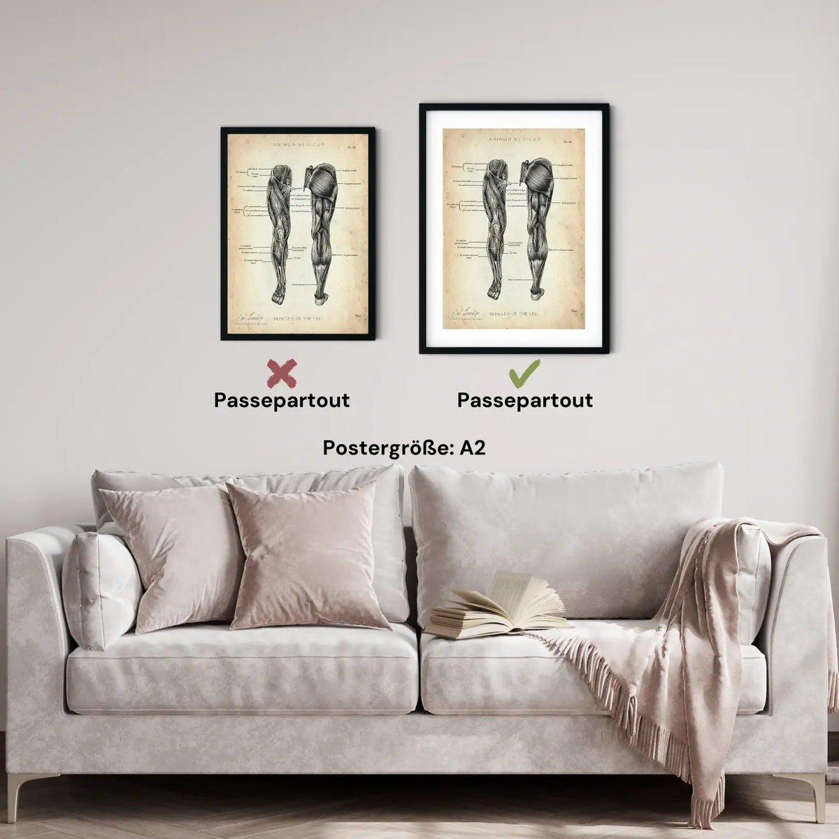 Beinmuskulatur Anatomie - Animus Medicus GmbH