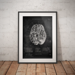 Circulus arteriosus willisii - Chalkboard - Animus Medicus GmbH