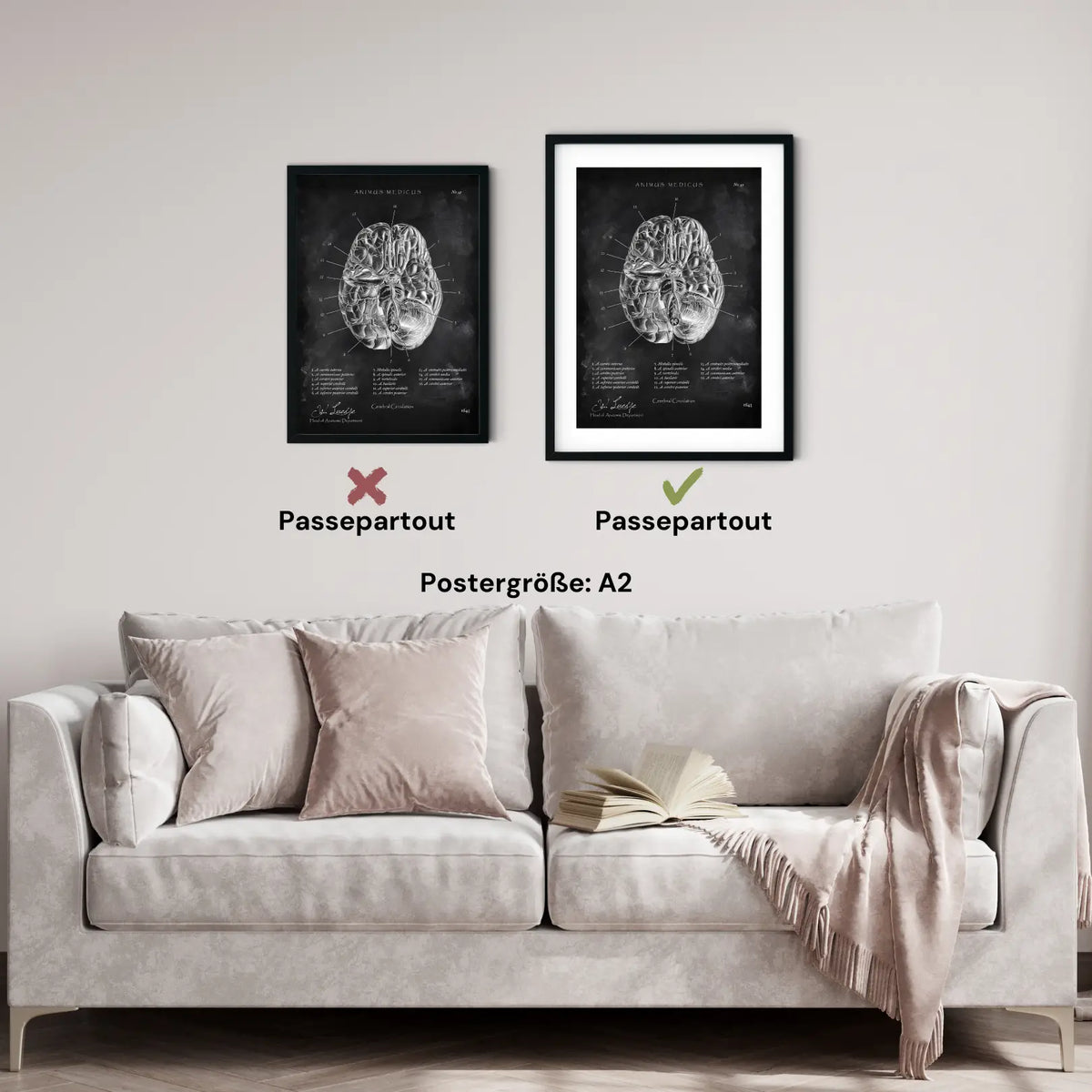 Circulus arteriosus willisii - Chalkboard - Animus Medicus GmbH