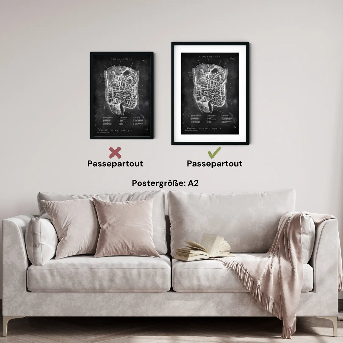 Der Bauch im Schnitt - Chalkboard - Animus Medicus GmbH
