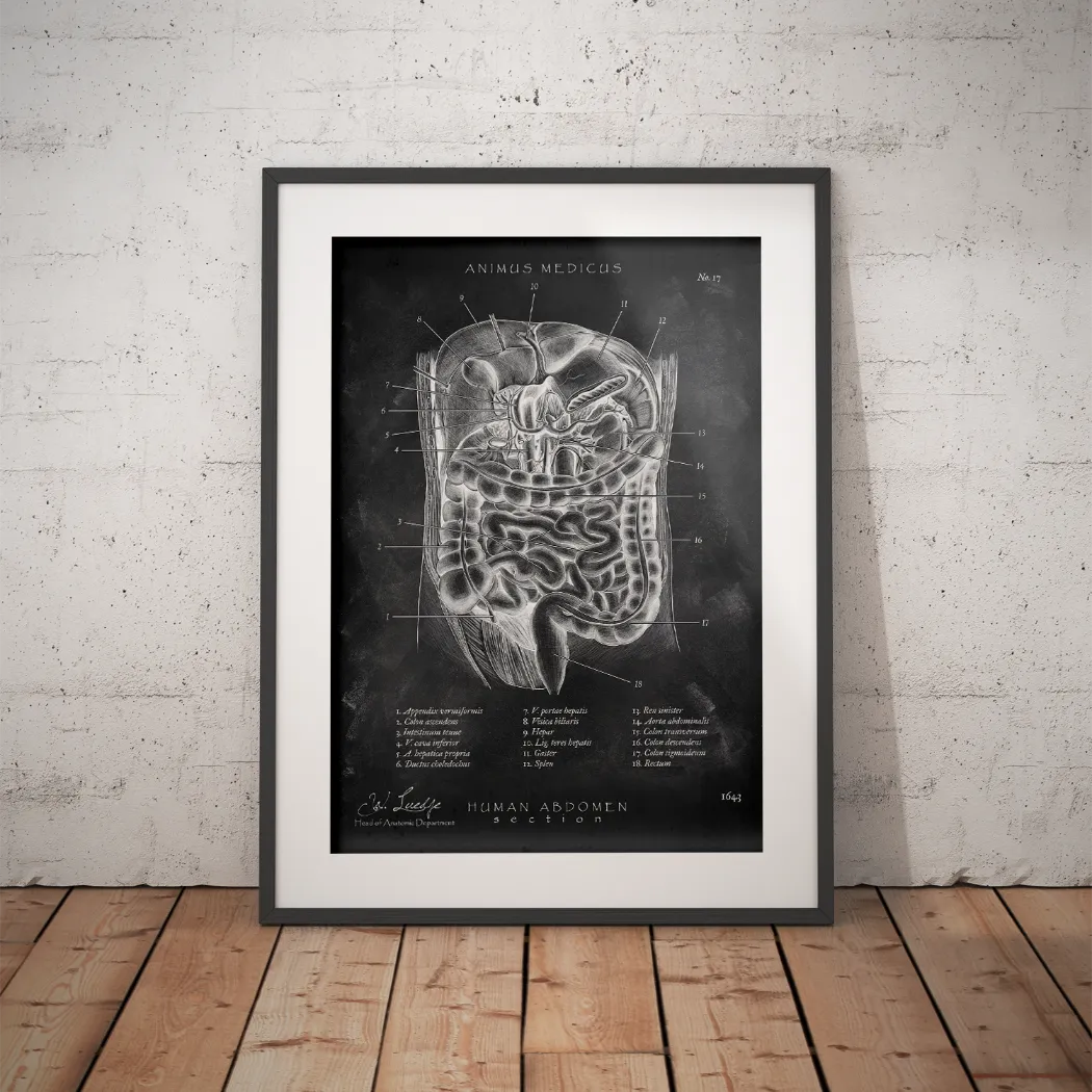 Der Bauch im Schnitt - Chalkboard - Animus Medicus GmbH