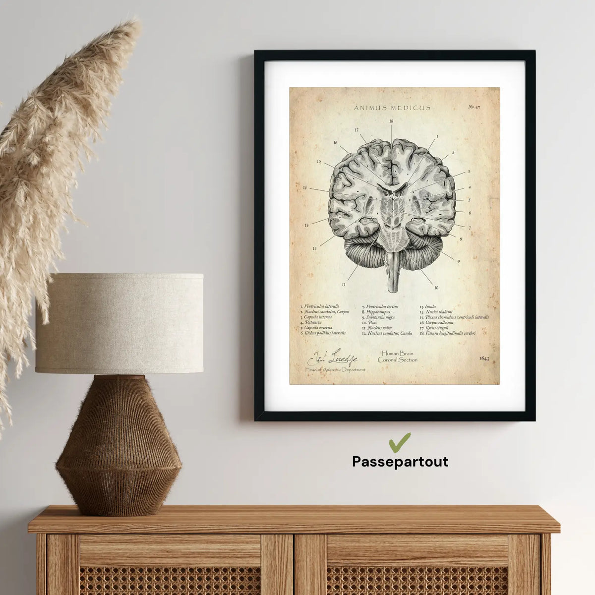 Gehirn Aufbau im Schnitt - Animus Medicus GmbH