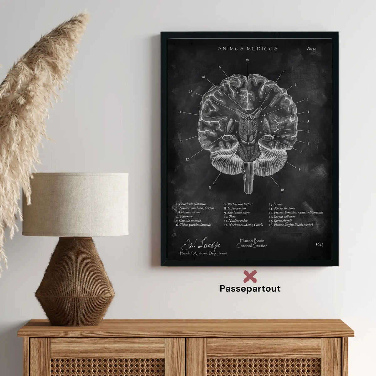 Gehirn Aufbau im Schnitt - Chalkboard - Animus Medicus GmbH