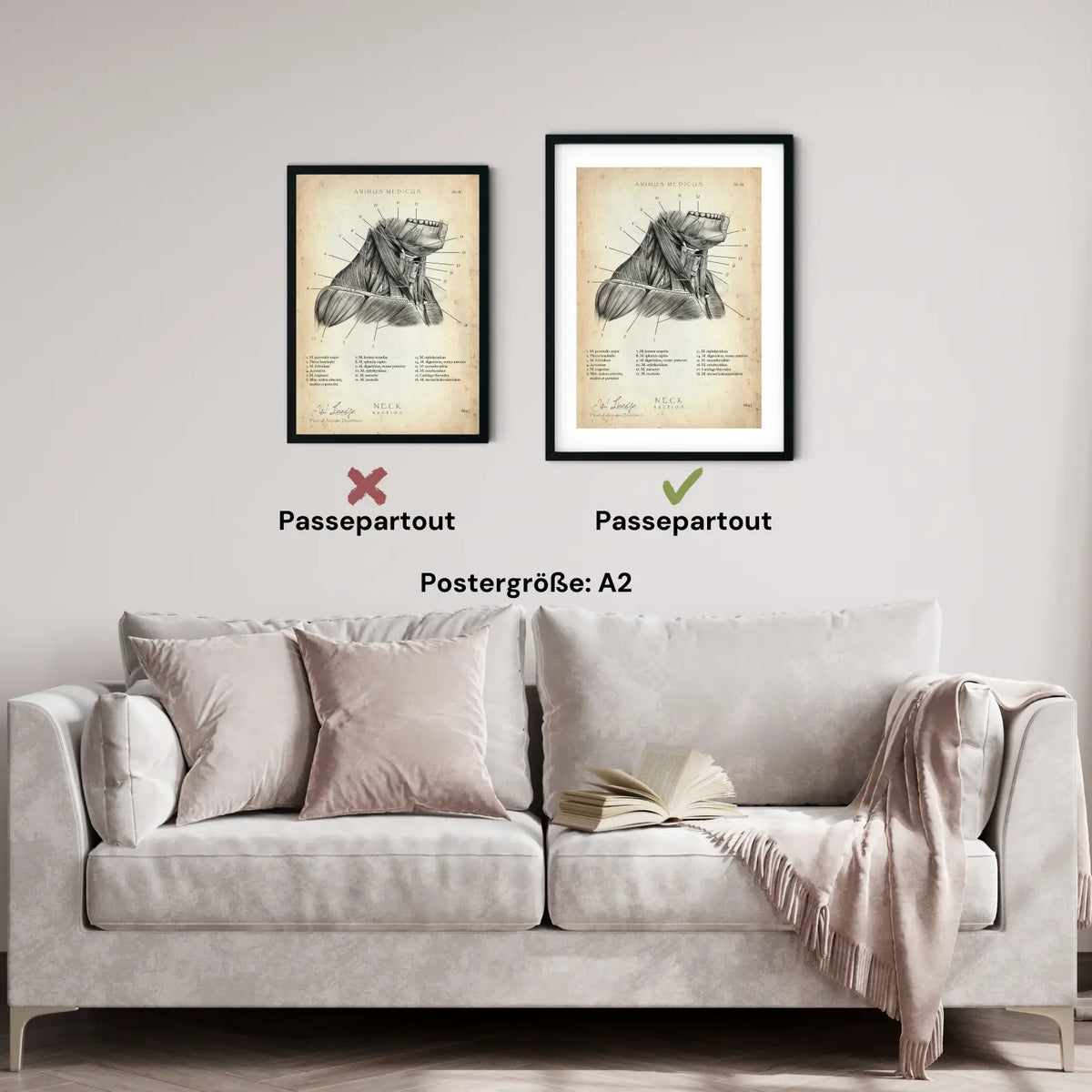 Halsmuskeln im Schnitt - Animus Medicus GmbH