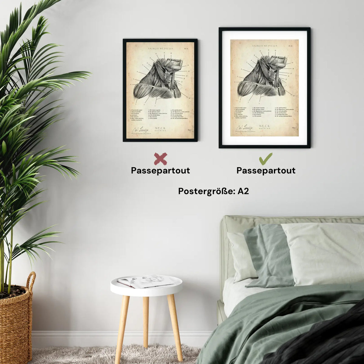 Halsmuskeln im Schnitt - Animus Medicus GmbH