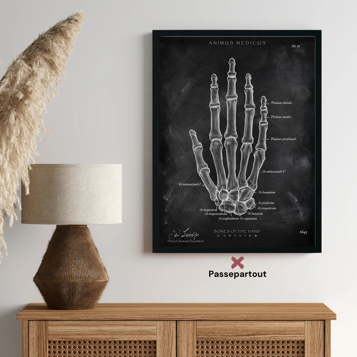 Handknochen Anatomie - Chalkboard - Animus Medicus GmbH