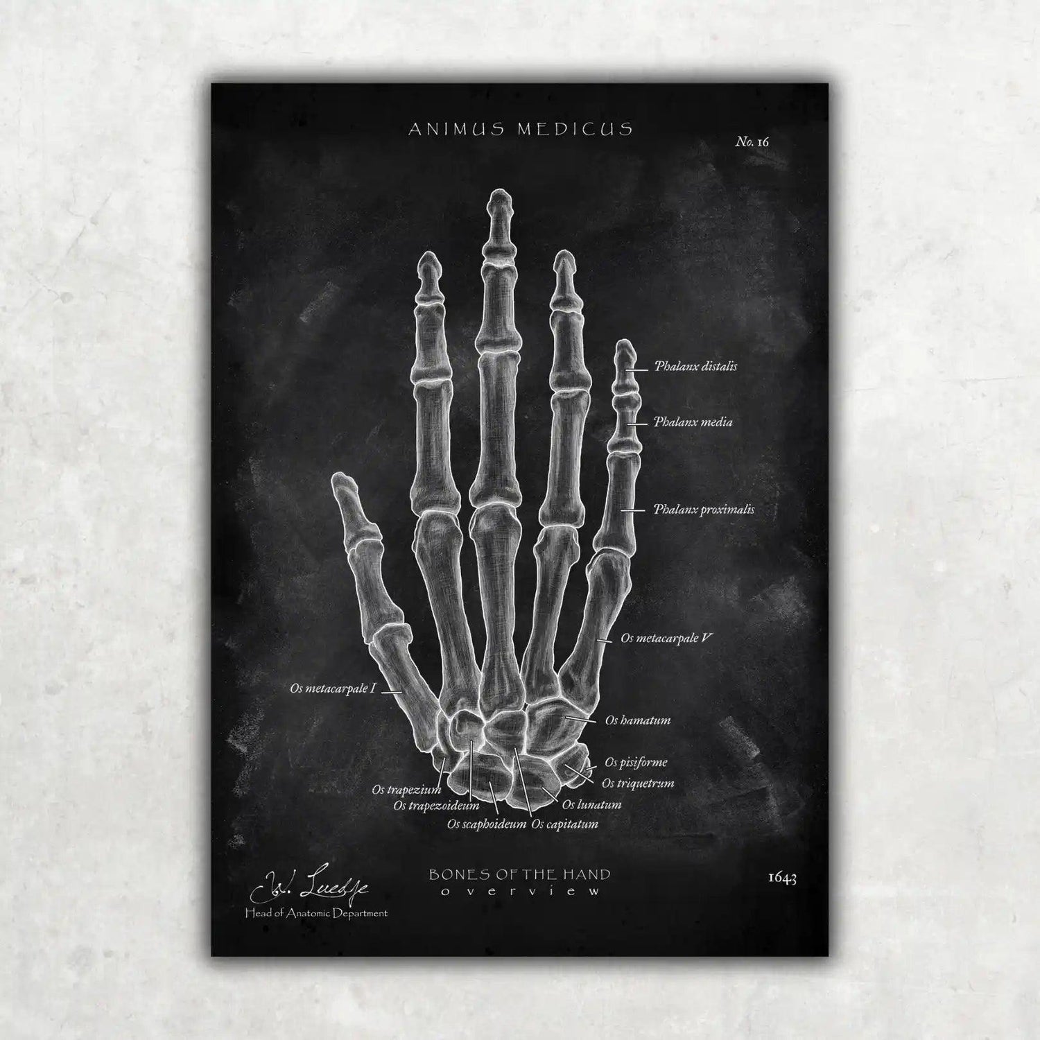 Handknochen Anatomie - Chalkboard - Animus Medicus GmbH