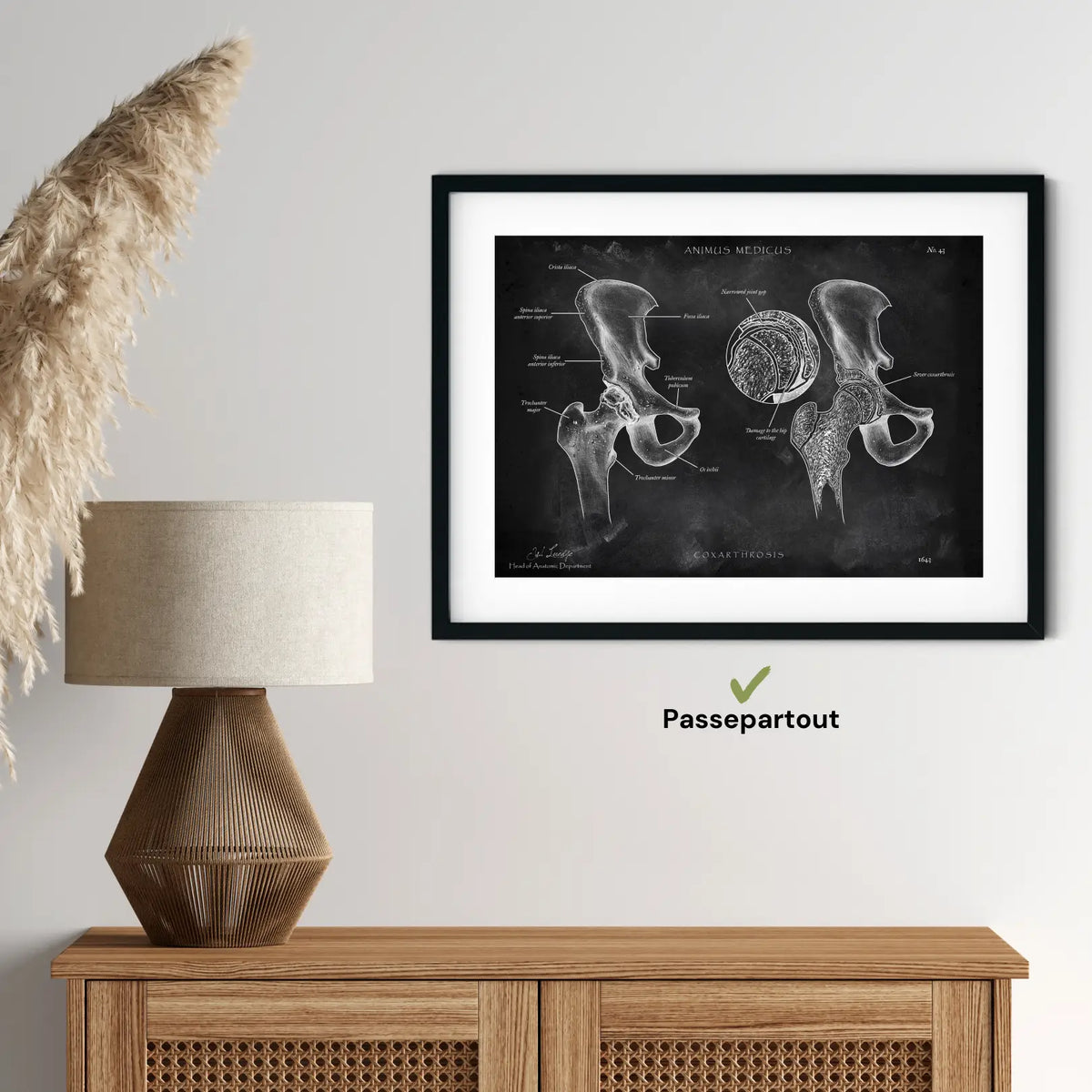 Hüftarthrose - Chalkboard - Animus Medicus GmbH