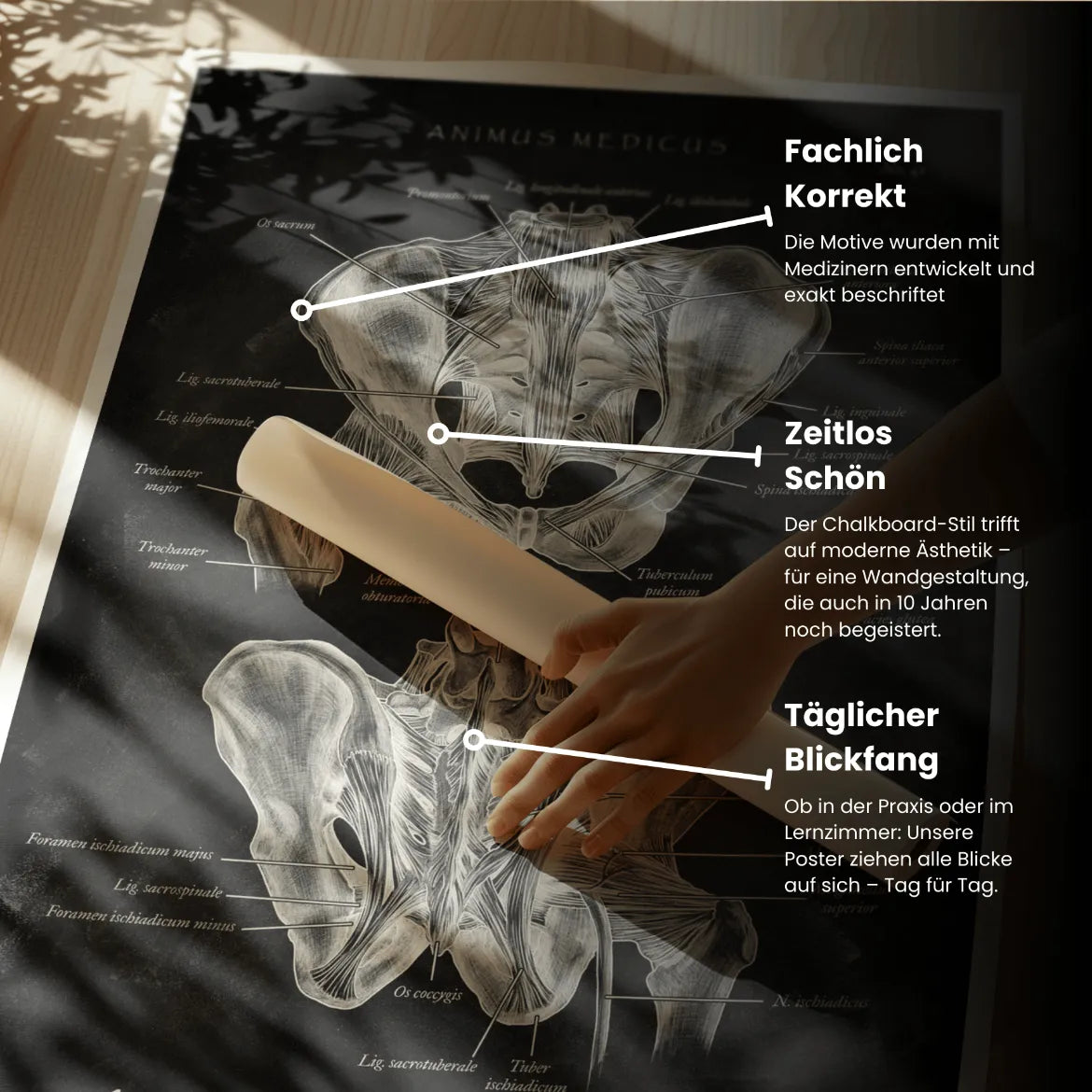 Hüftgelenk Anatomie - Chalkboard - Animus Medicus GmbH