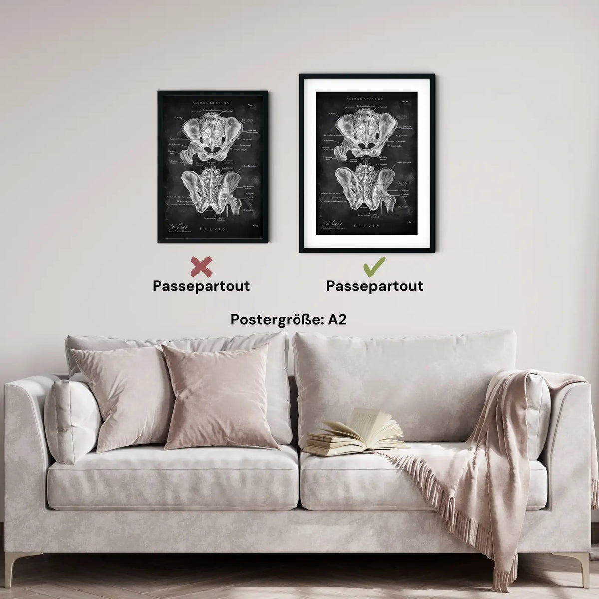 Hüftgelenk Anatomie - Chalkboard - Animus Medicus GmbH