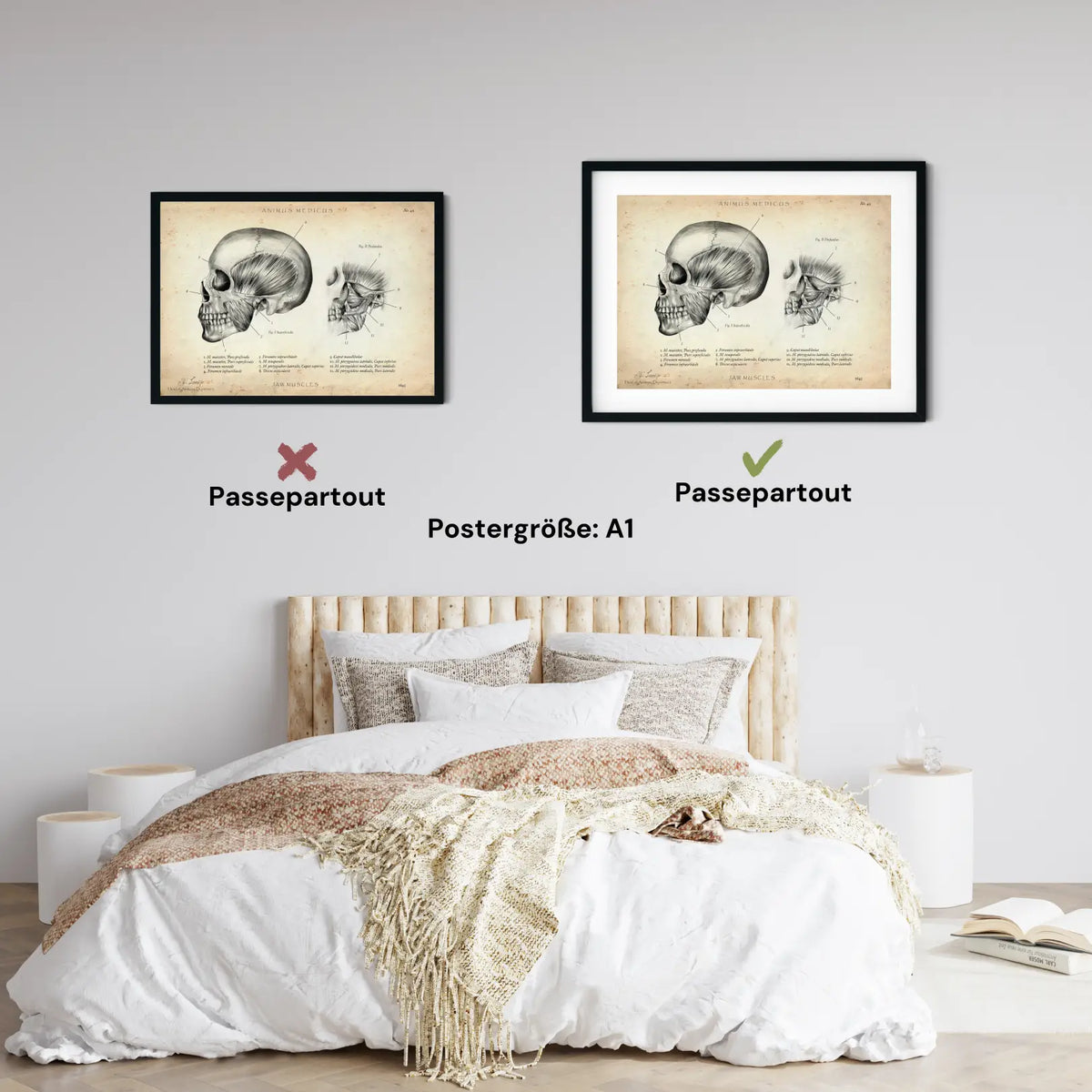 Kaumuskulatur Anatomie - Animus Medicus GmbH