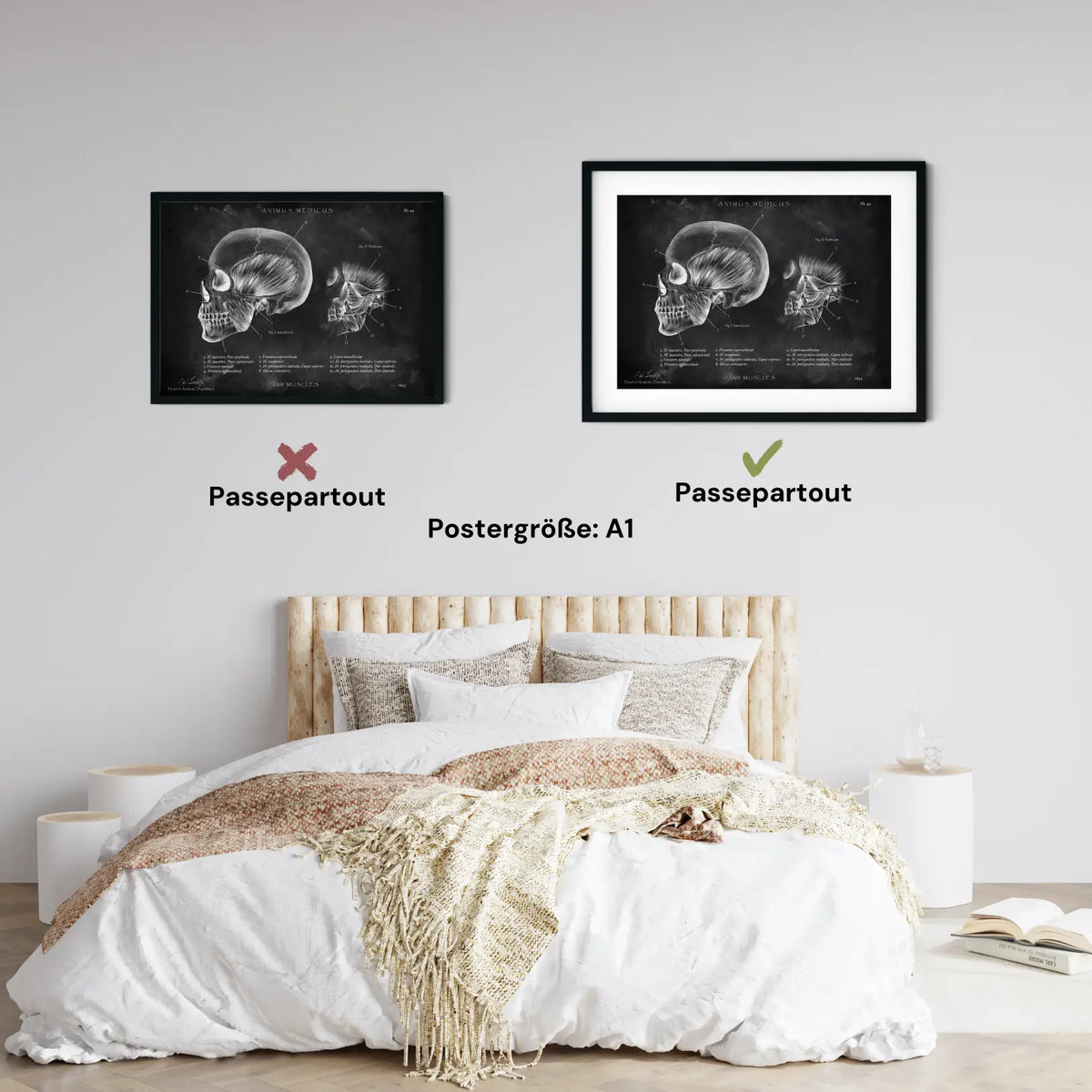 Kaumuskulatur Anatomie - Chalkboard - Animus Medicus GmbH