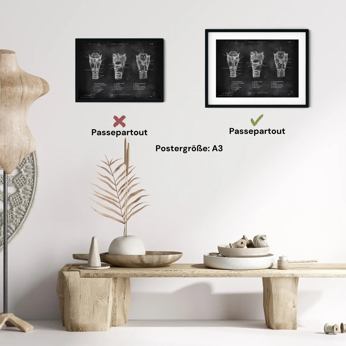 Kehlkopf Anatomie - Chalkboard - Animus Medicus GmbH