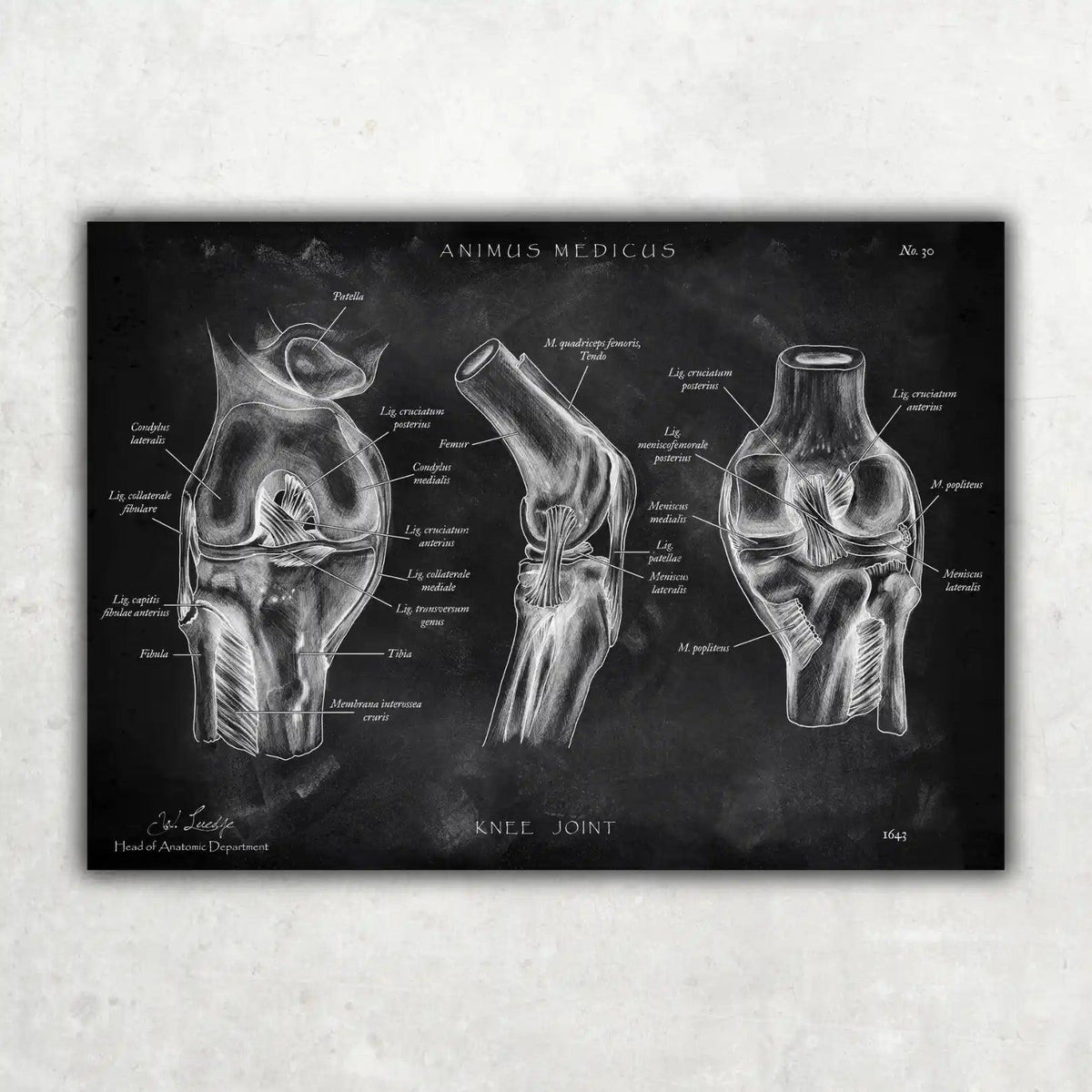 Knie Anatomie Sammlung - Chalkboard - Animus Medicus GmbH