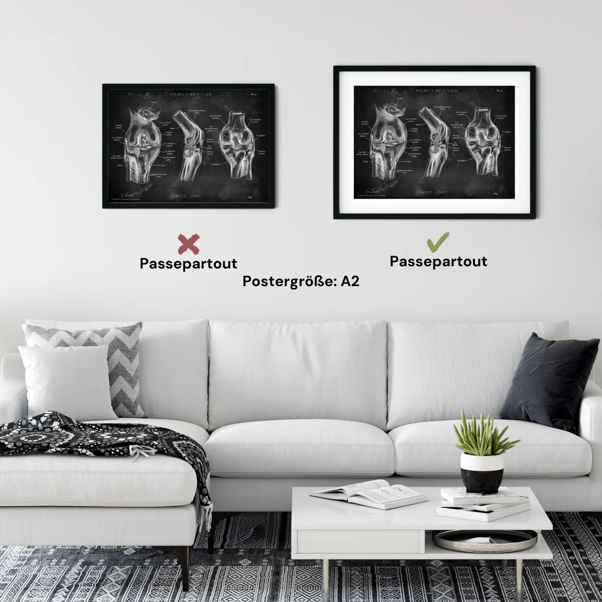 Kniegelenk Anatomie - Chalkboard - Animus Medicus GmbH