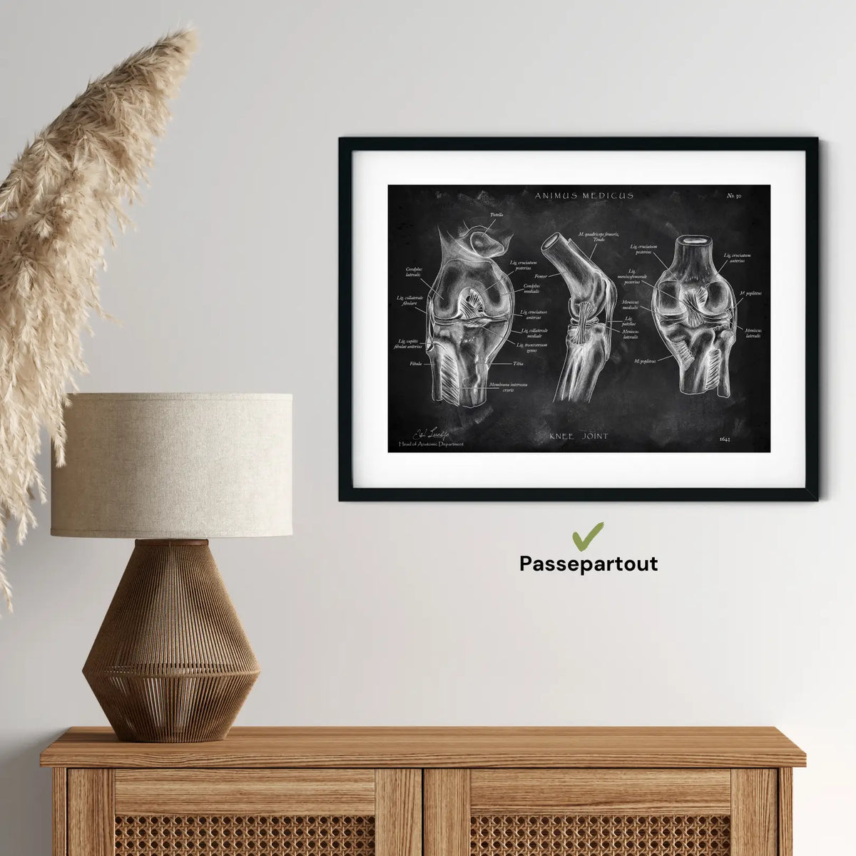 Kniegelenk Anatomie - Chalkboard - Animus Medicus GmbH