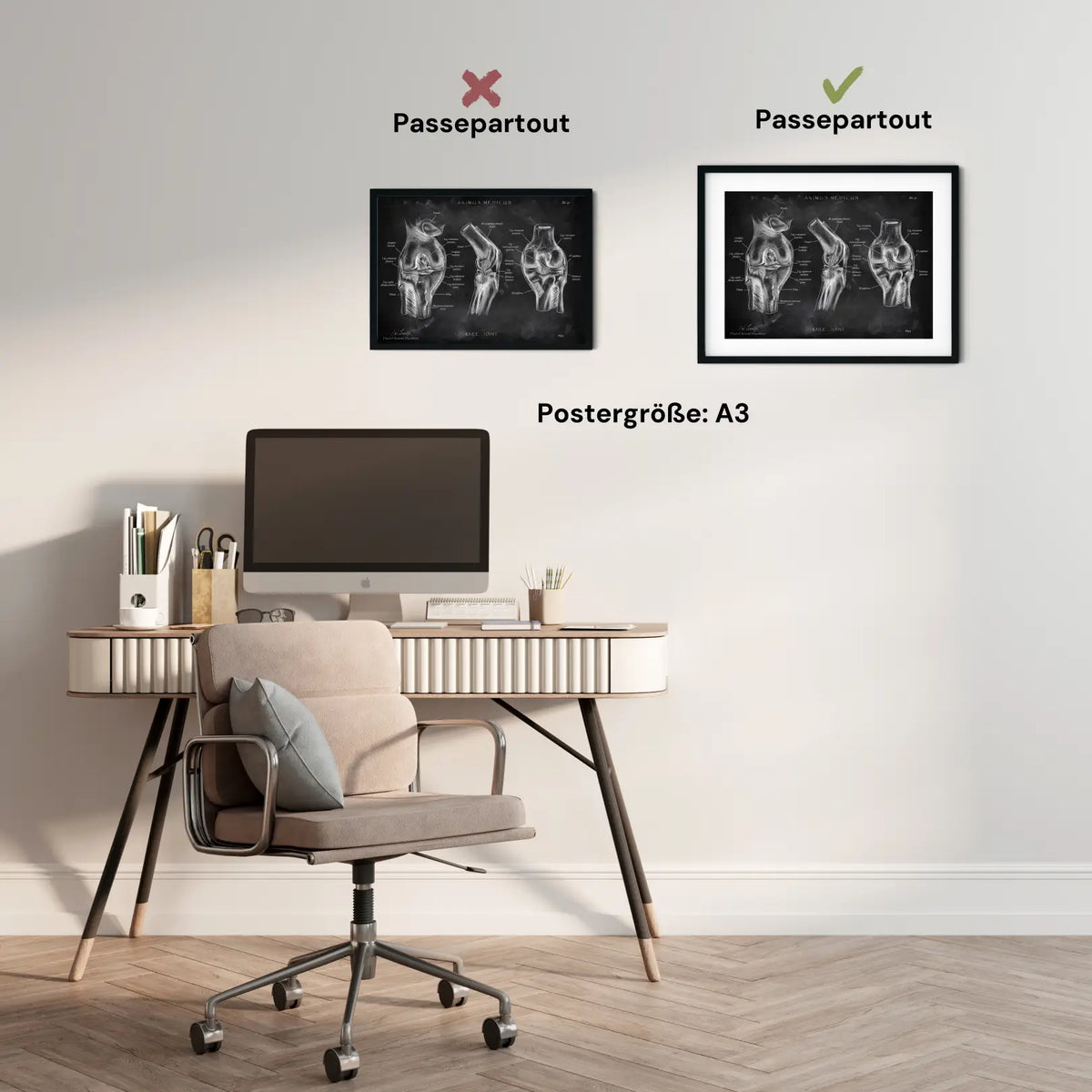 Kniegelenk Anatomie - Chalkboard - Animus Medicus GmbH