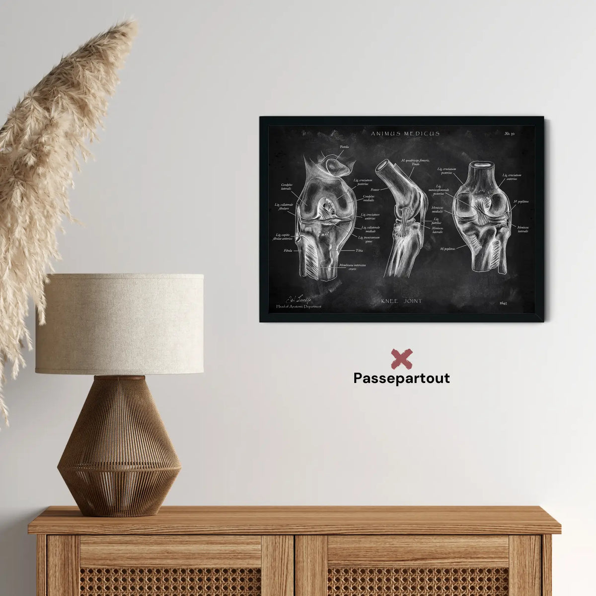 Kniegelenk Anatomie - Chalkboard - Animus Medicus GmbH