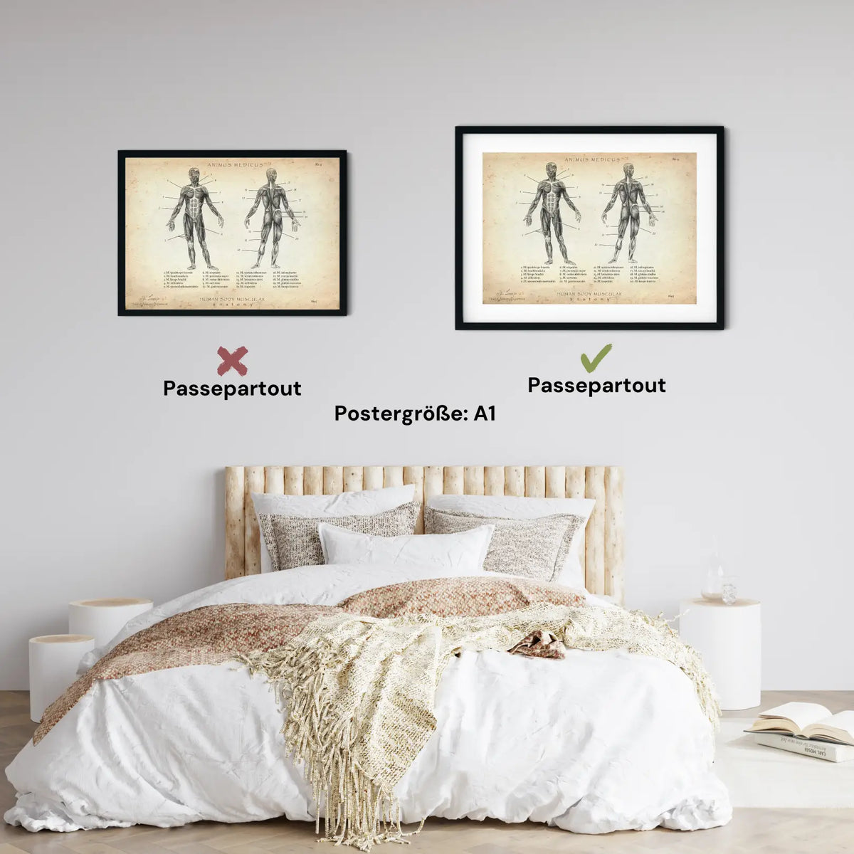 Muskeln Anatomie - Animus Medicus GmbH