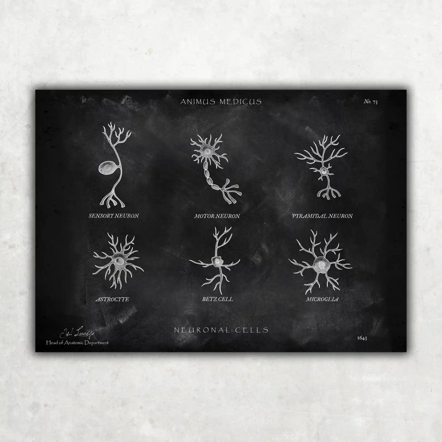 Neuronale Zellen - Chalkboard - Animus Medicus GmbH