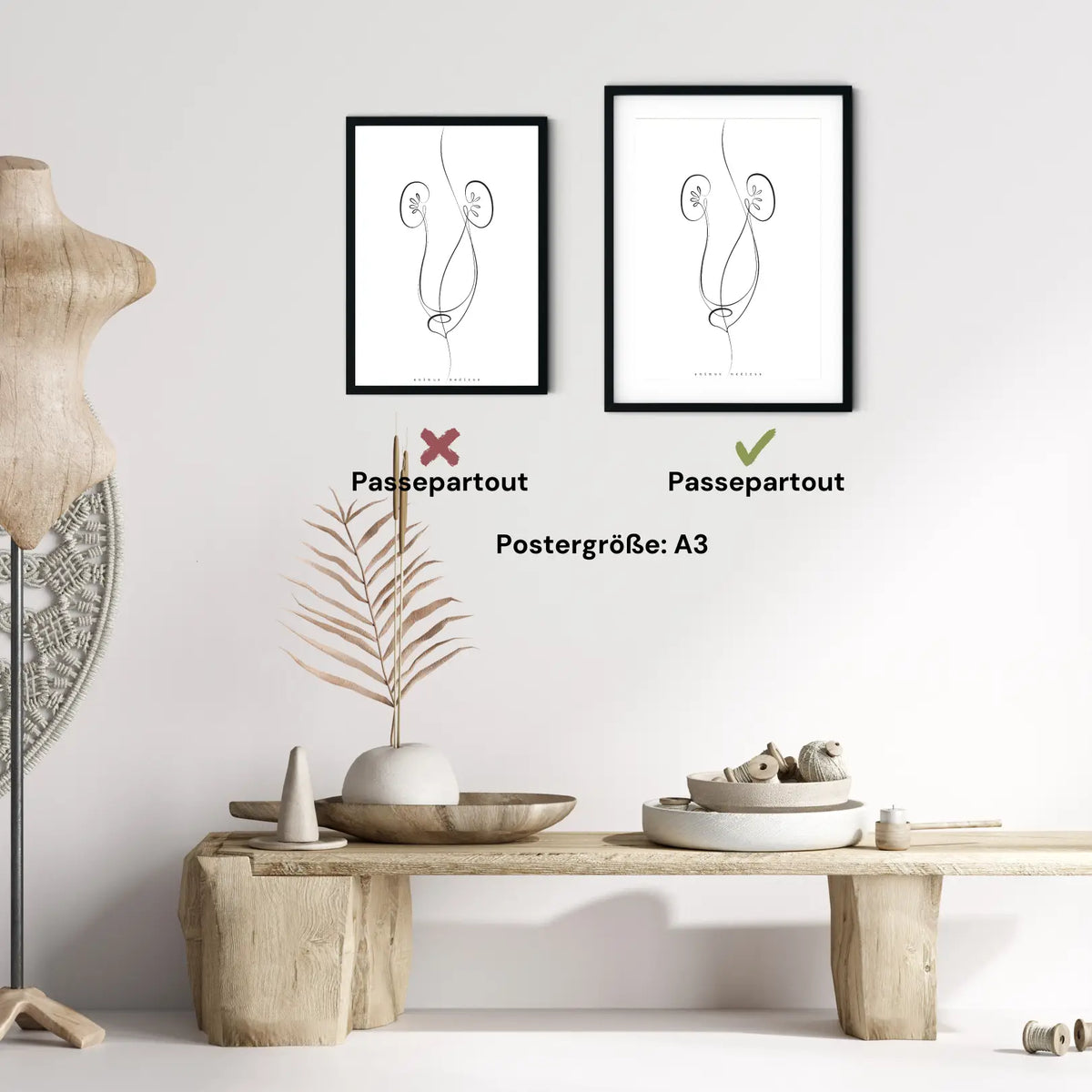 Nieren Anatomie Minimalist - Animus Medicus GmbH