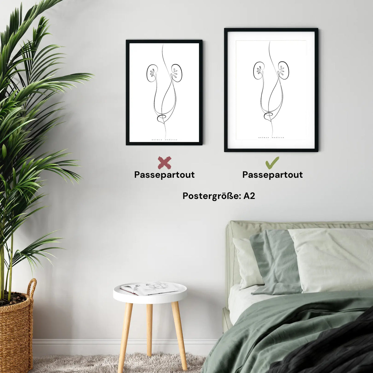 Nieren Anatomie Minimalist - Animus Medicus GmbH