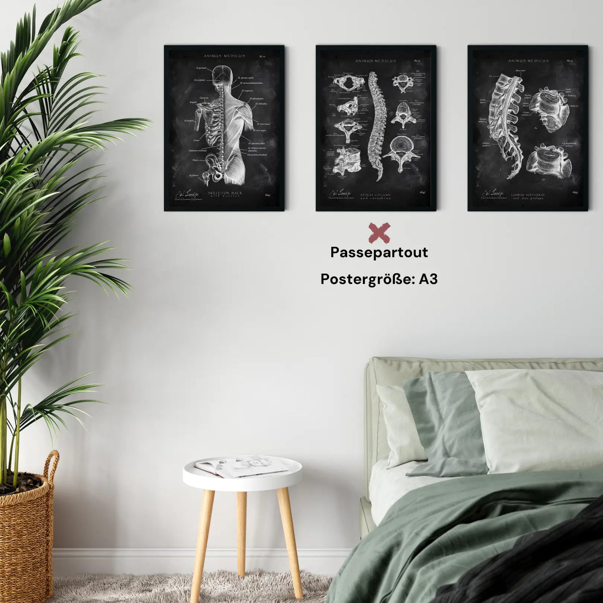 Rücken Anatomie Sammlung - Chalkboard - Animus Medicus GmbH