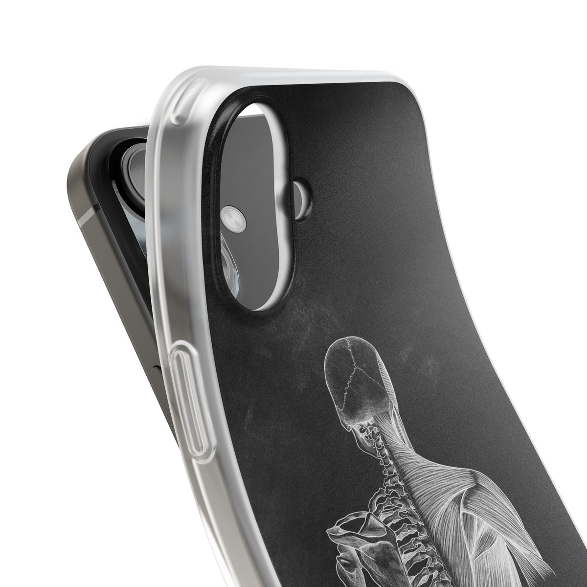 Rücken - Chalkboard - Animus Medicus GmbH