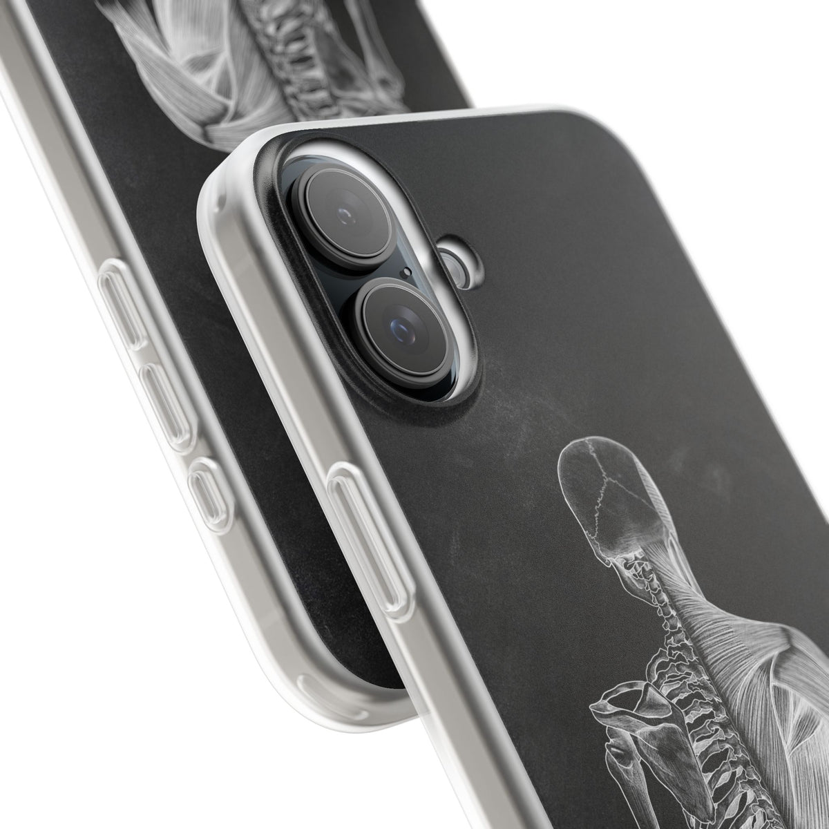 Rücken - Chalkboard - Animus Medicus GmbH