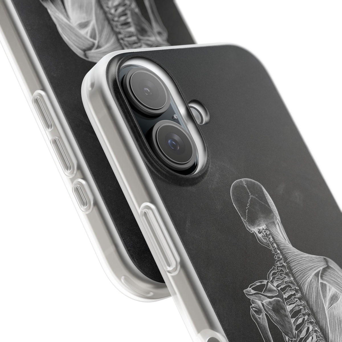 Rücken - Chalkboard - Animus Medicus GmbH