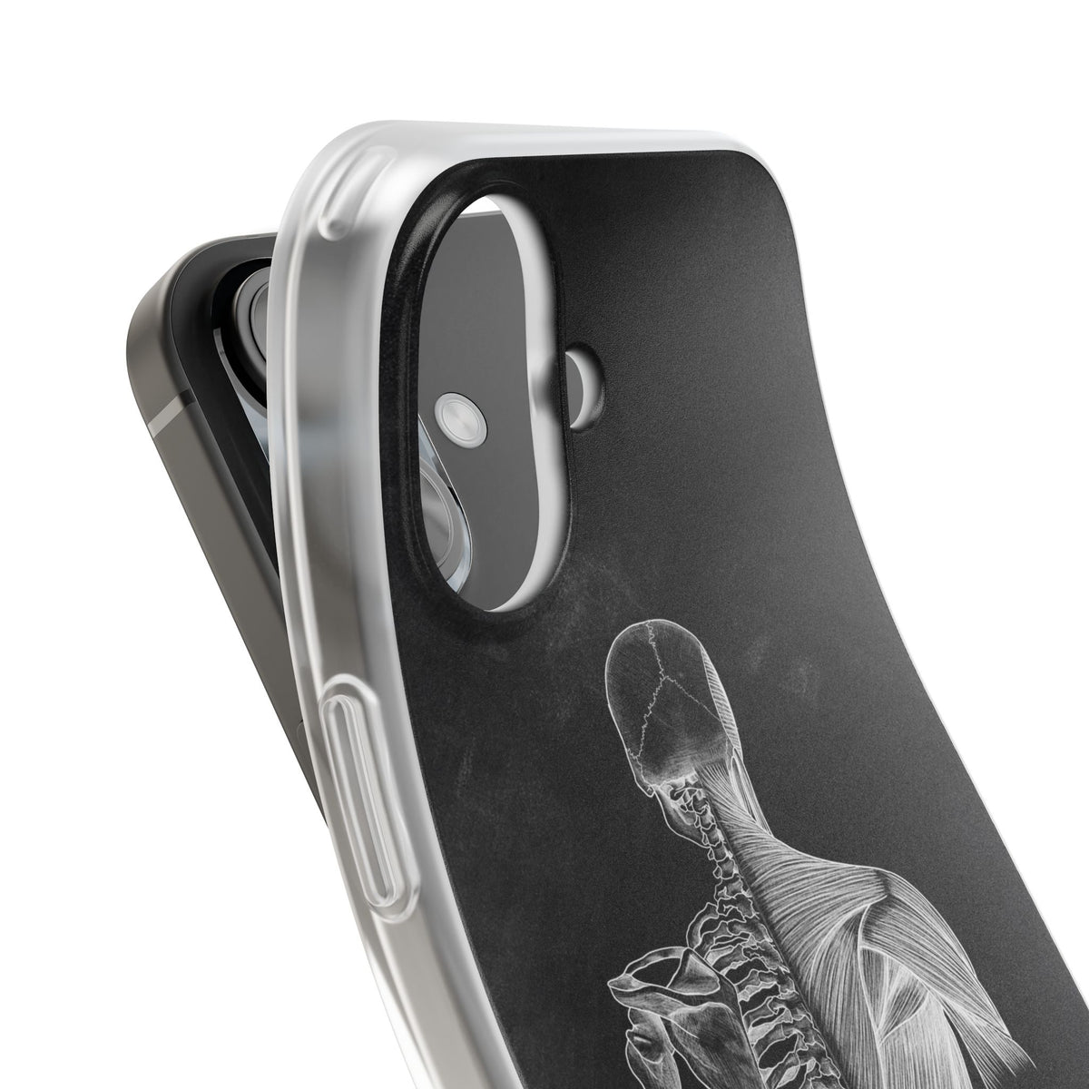 Rücken - Chalkboard - Animus Medicus GmbH