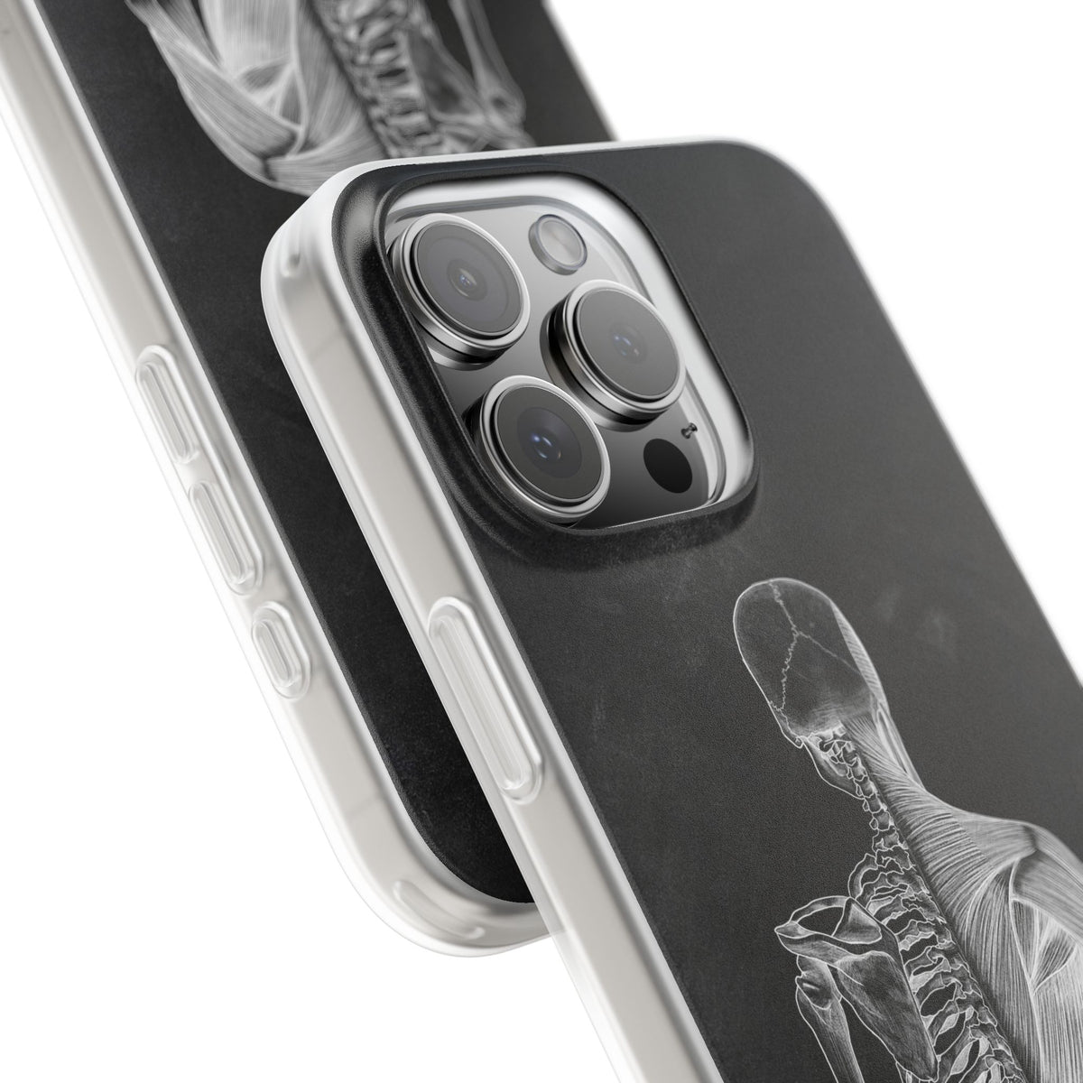 Rücken - Chalkboard - Animus Medicus GmbH