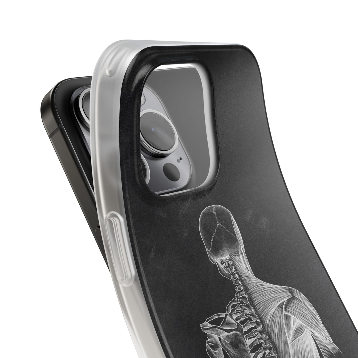 Rücken - Chalkboard - Animus Medicus GmbH