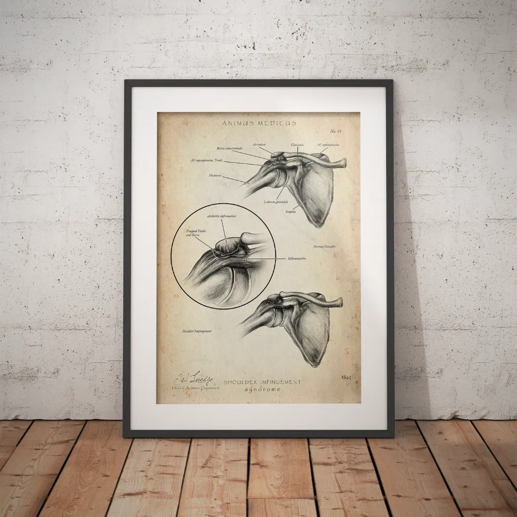 Schulter Anatomie Sammlung - Animus Medicus GmbH