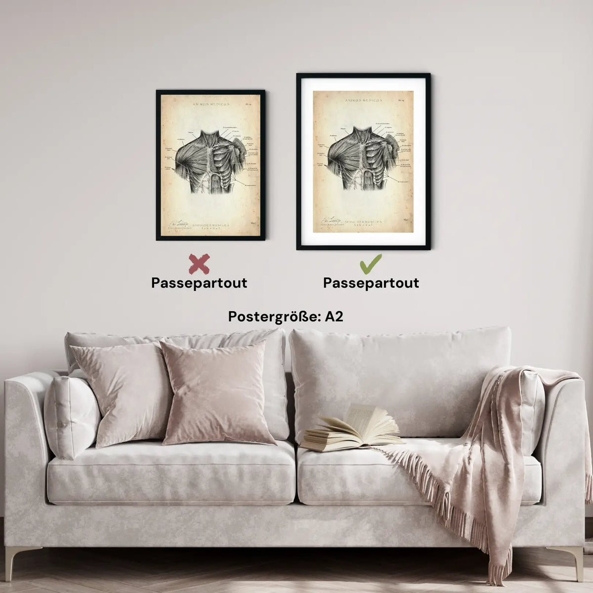 Schulter Muskulatur - Animus Medicus GmbH