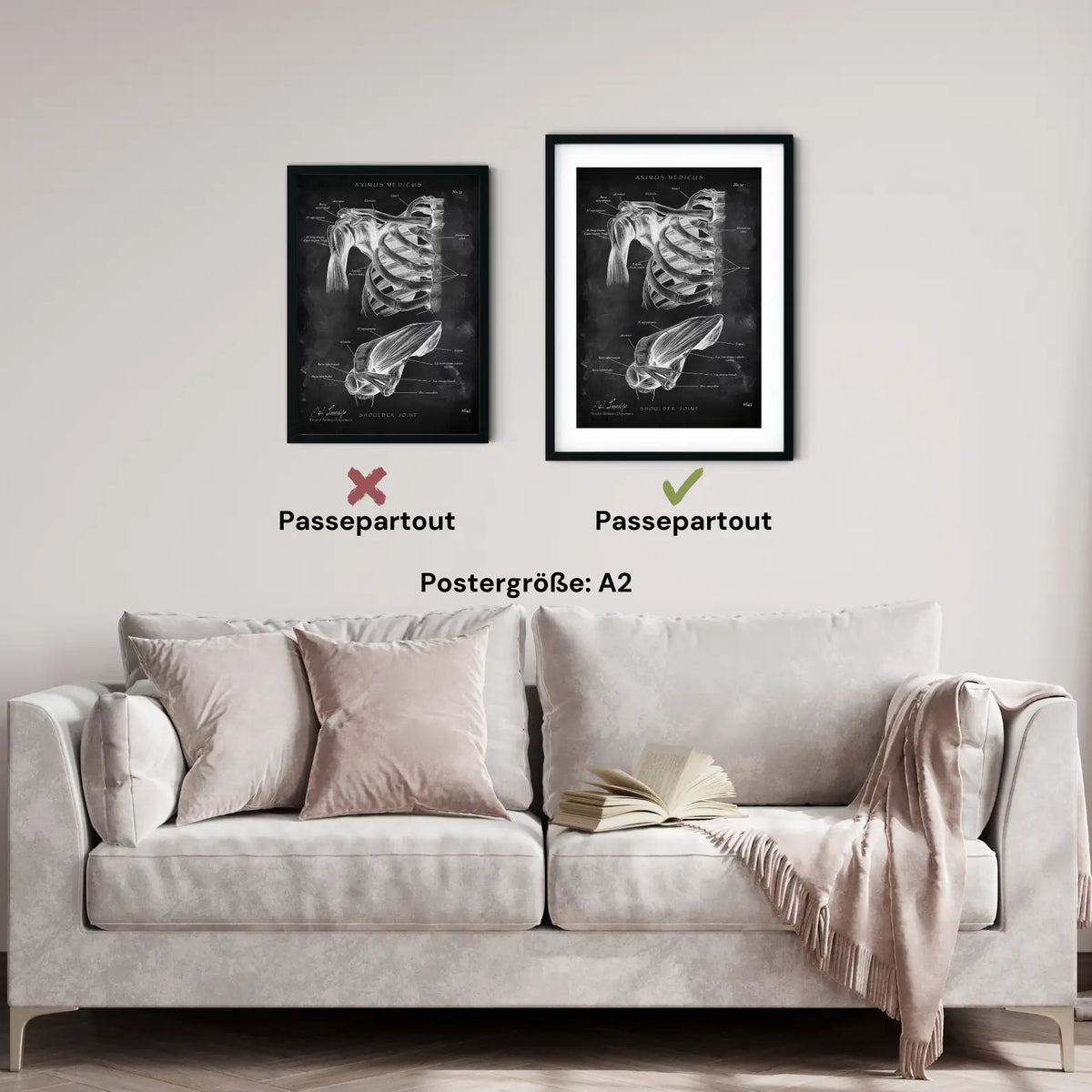 Schultergelenk Anatomie - Chalkboard - Animus Medicus GmbH