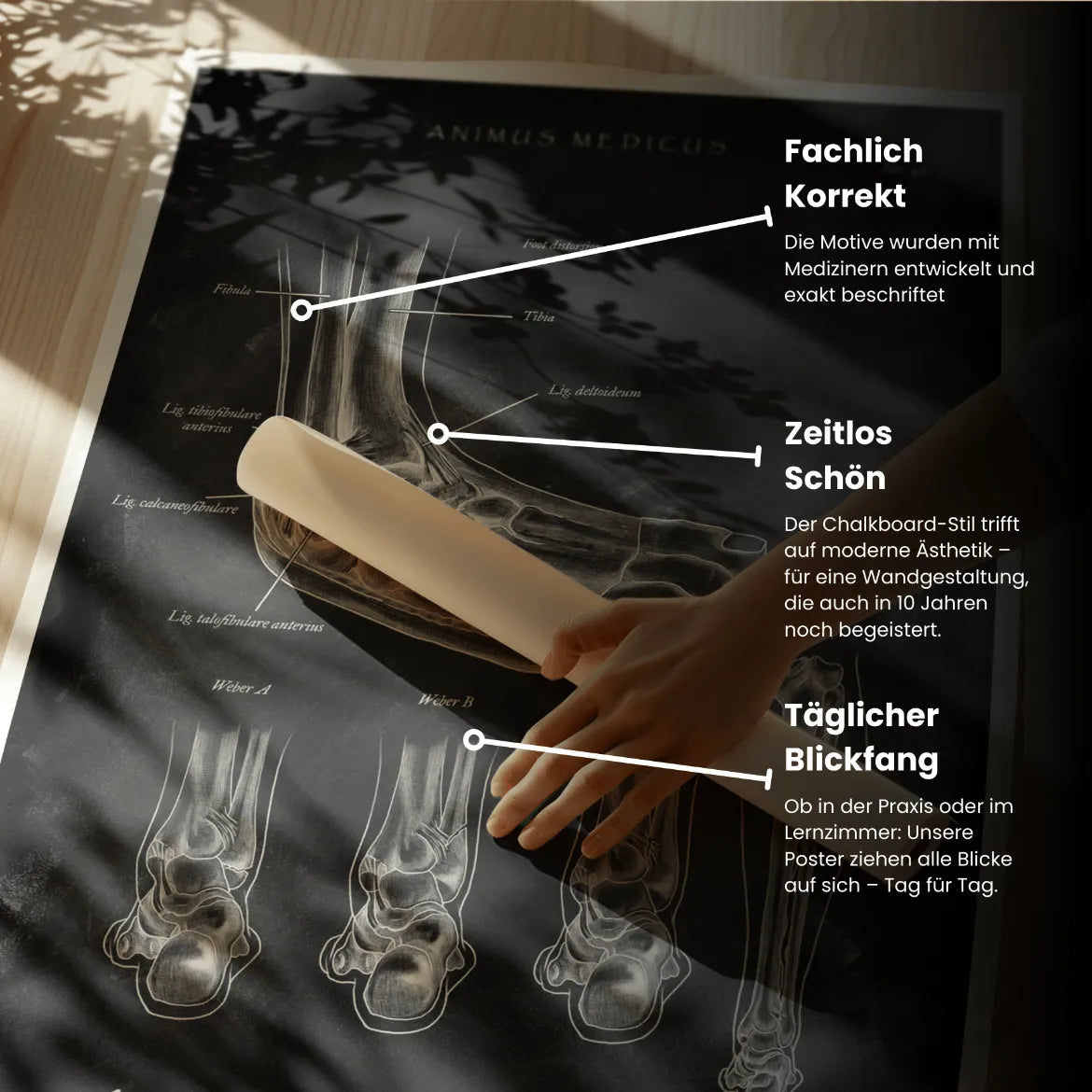 Sprunggelenk mit Bänderriss - Chalkboard - Animus Medicus GmbH