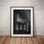 Sprunggelenk mit Bänderriss - Chalkboard - Animus Medicus GmbH