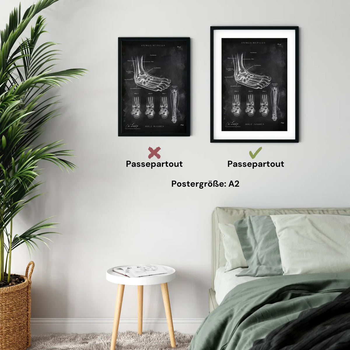 Sprunggelenk mit Bänderriss - Chalkboard - Animus Medicus GmbH