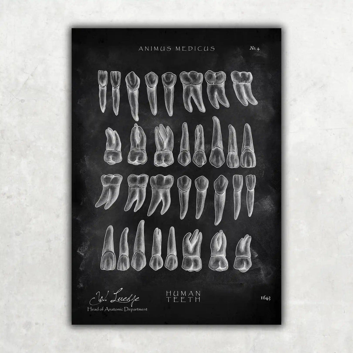 Übersicht der Zähne - Chalkboard - Animus Medicus GmbH