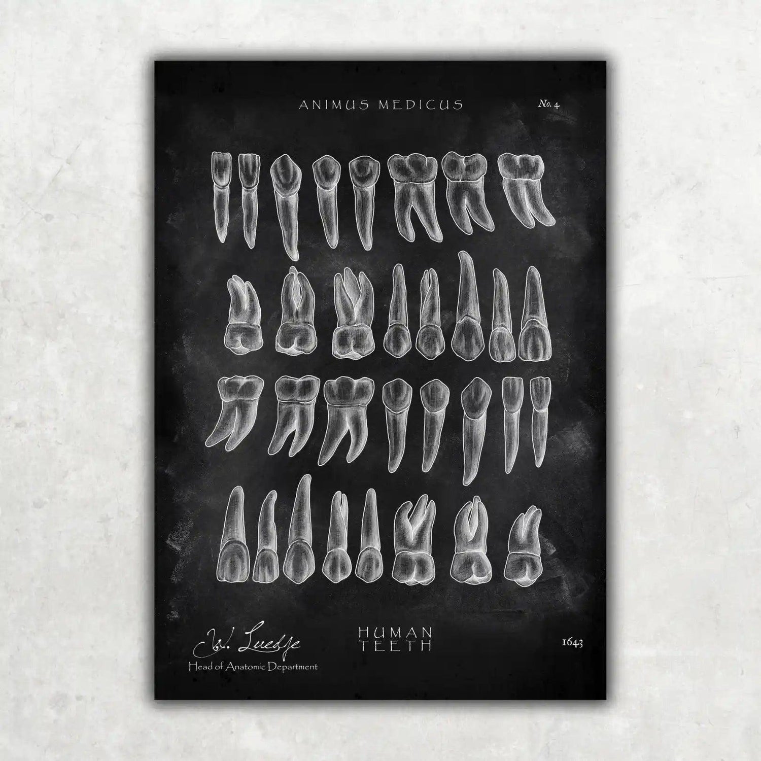 Übersicht der Zähne - Chalkboard - Animus Medicus GmbH