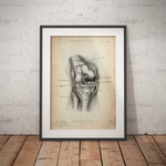 Unhappy Triad Knie - Animus Medicus GmbH